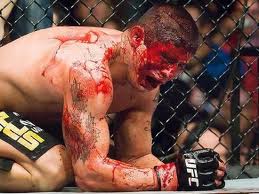 Okładki Z UFC - blood.jpg