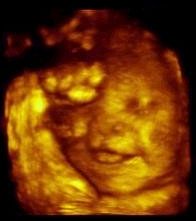 ABORCJA-WSPÓŁCZESNA RZEŻ NIEWINIĄTEK - uśmiech dziecka - 40 tydzień.jpg