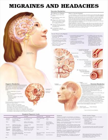 plansze dydaktyczne - budowa ciała człowieka ENG - migrena.jpg